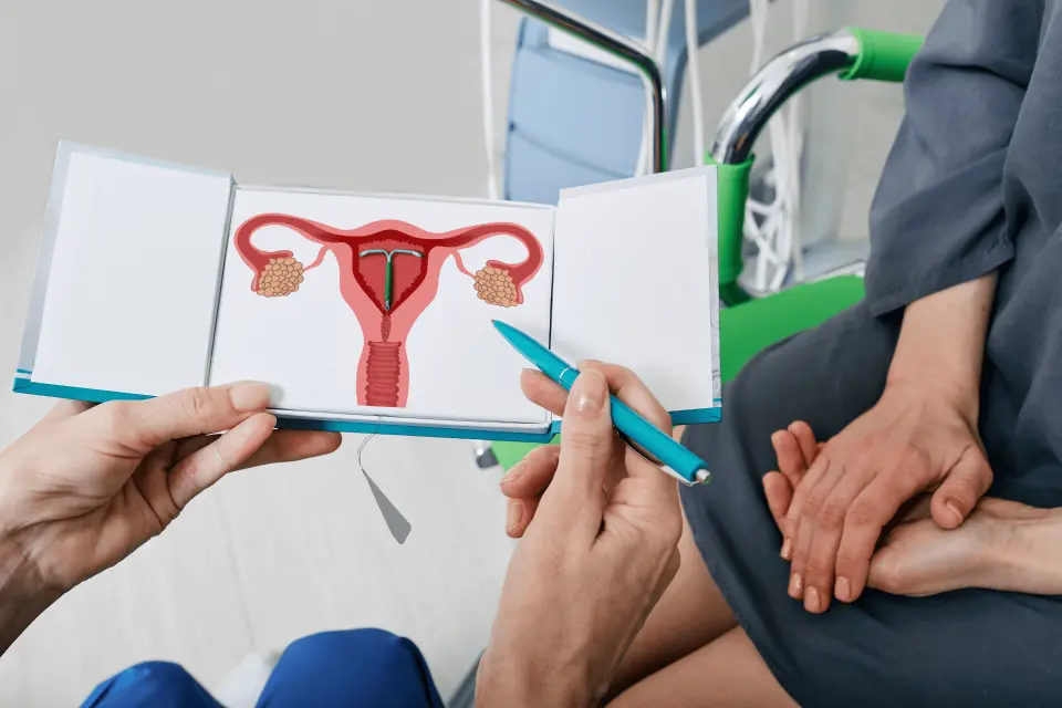 IUD Insertion: What to Expect Before, During, and After