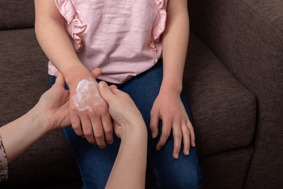 Natural Eczema Treatment: Remedies That Really Work