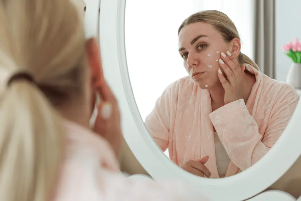 Skincare for Acne-Prone Skin: Balancing Treatment and Sun Protection