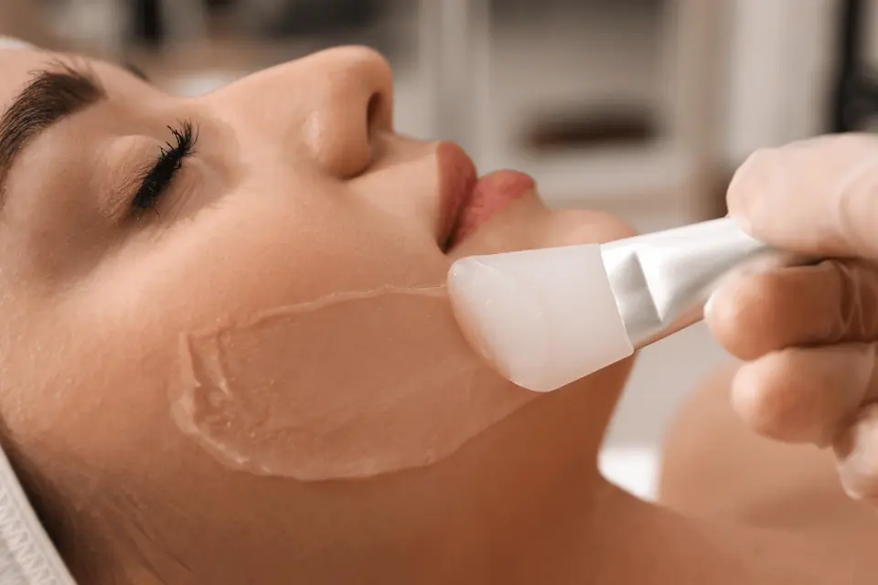 Chemical Peels for Acne Scars: Types, Results, and Downtime