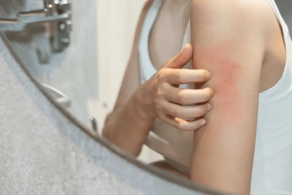 Red Spots on Your Skin: When to Treat at Home vs. See a Doctor