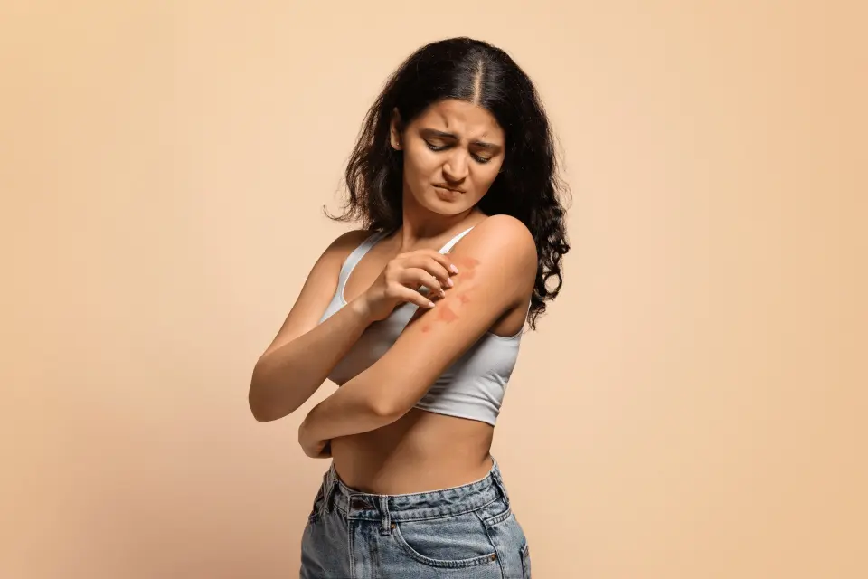 Types of Skin Eruptions: A Visual Guide to Common Rashes