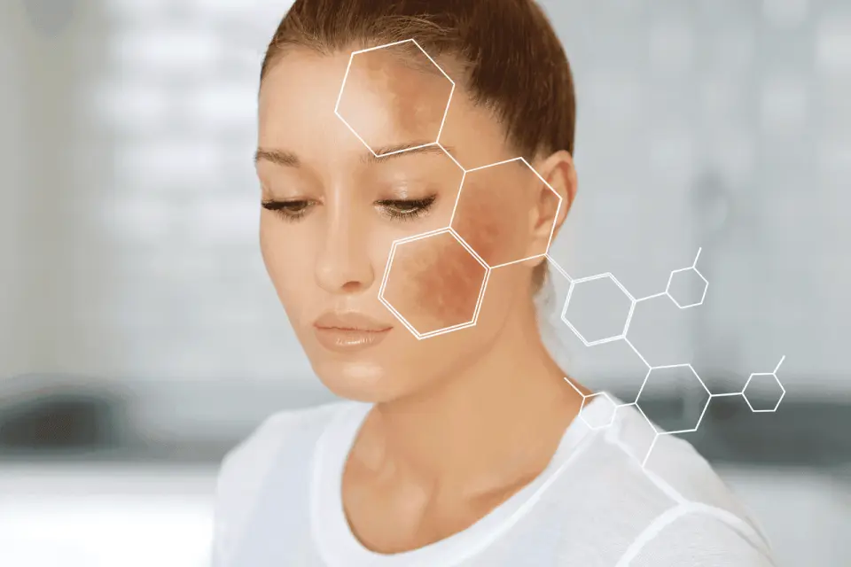 How to Lighten Hyperpigmentation Around Your Mouth