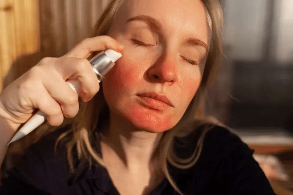 Best Cleansers for Rosacea: Gentle Options That Calm Redness