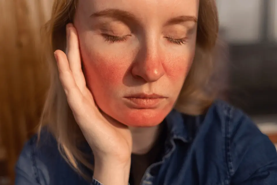 Rosacea vs. Eczema: How to Tell the Difference and Treat Each