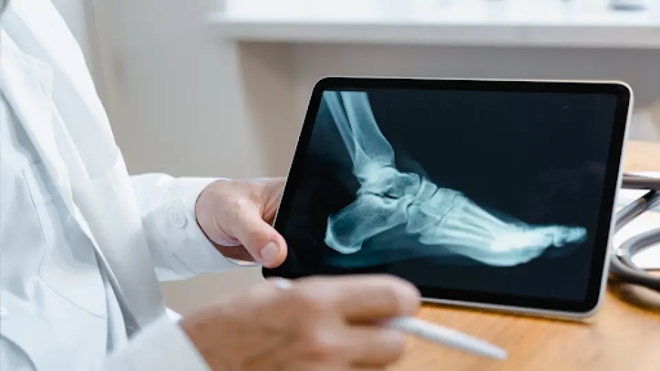 Does Urgent Care Do X-Rays for Broken Bones?