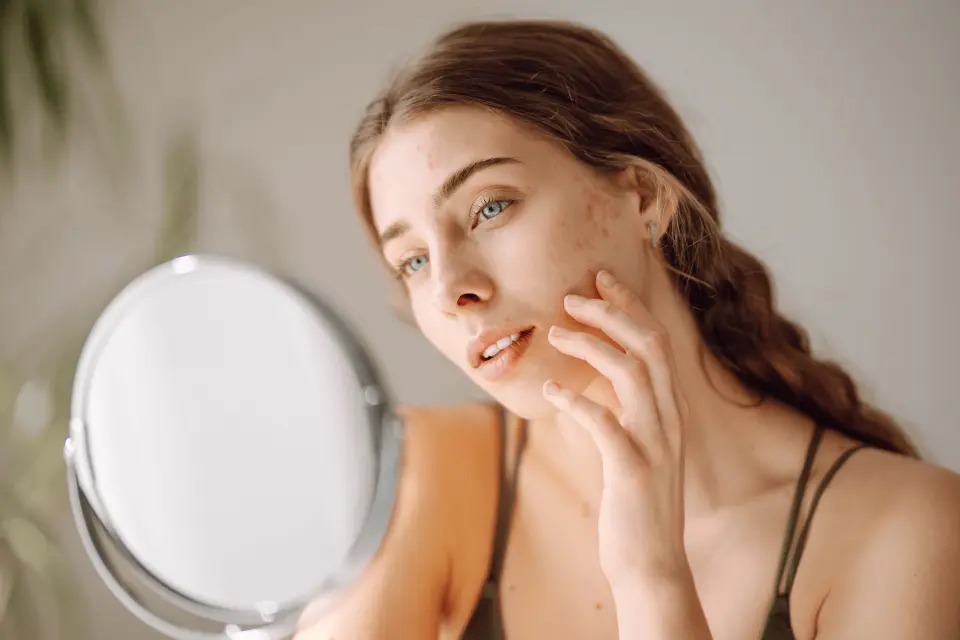 Facial Scars: Treatment Options from Topicals to Professional Procedures