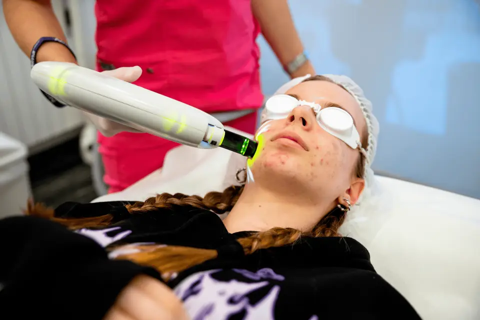 Laser Treatment for Acne Scars: Types, Costs, and Recovery Time